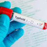 Every fifth typhoid death in country is from Telangana