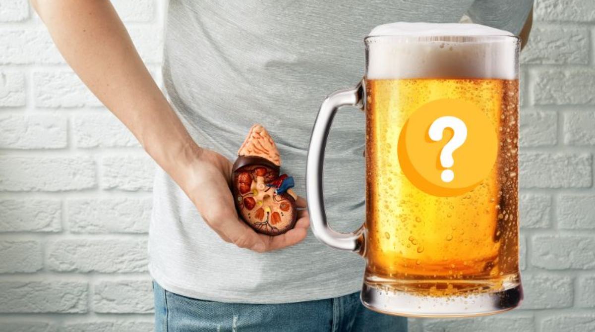 Beer for Kidney Stones: Myths Vs Facts