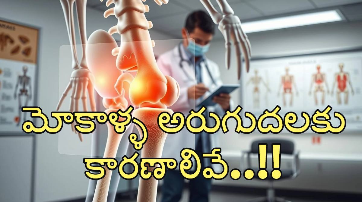 Osteoarthritis: What It Is, Causes, Treatment & Relief