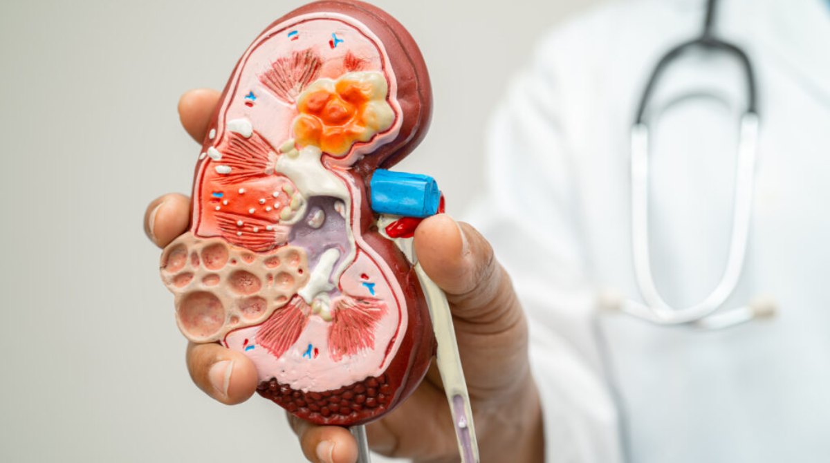 Swelling In These Body Parts Can Be A Sign Of Kidney Disease