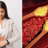 Top 5 lifestyle changes to improve your cholesterol