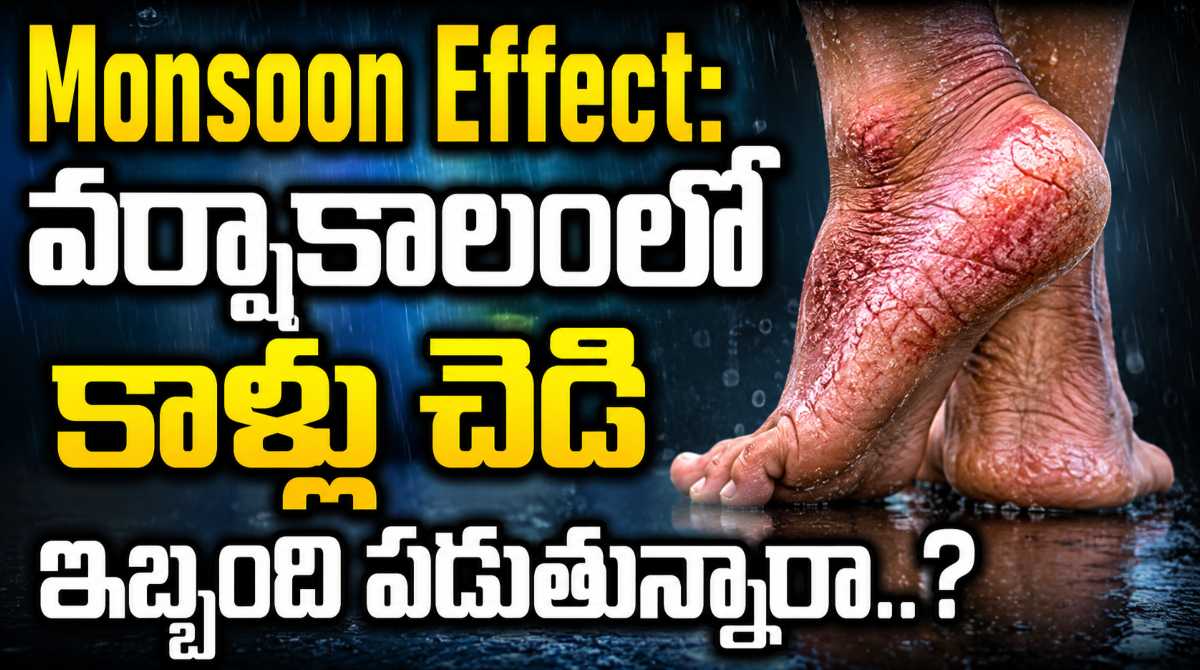 monsoon suffering from foot infections