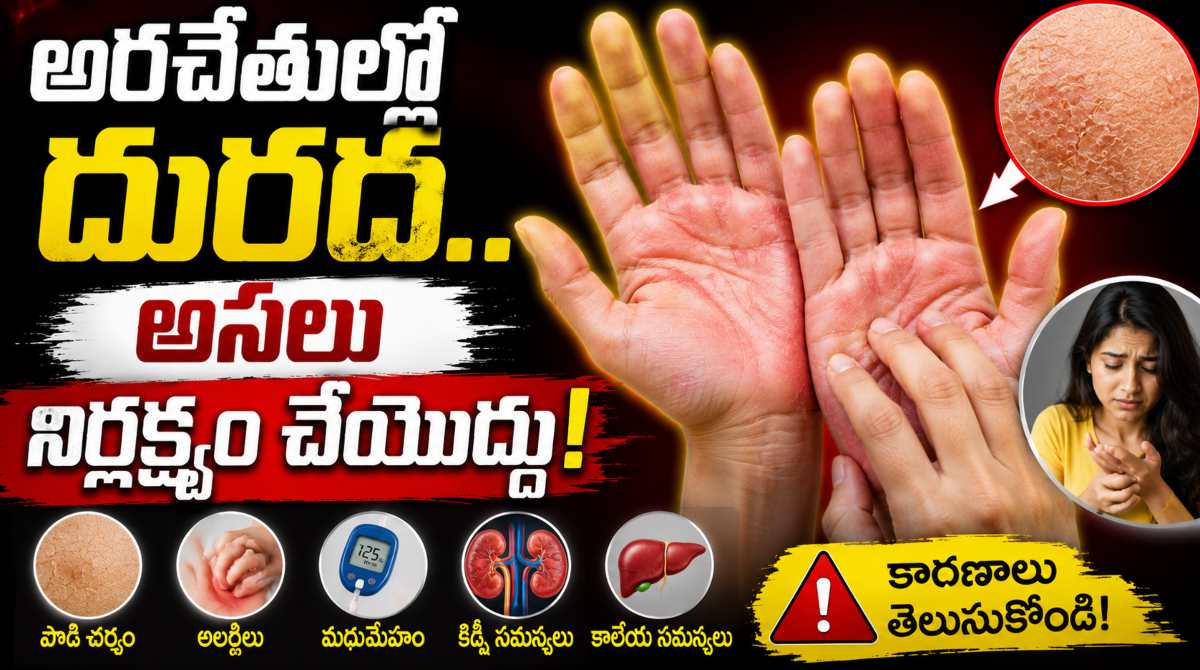 Itchy Palms: Causes, Symptoms & When to See a Doctor
