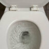 Doctors Advise: Take a Quick Look Before Flushing
